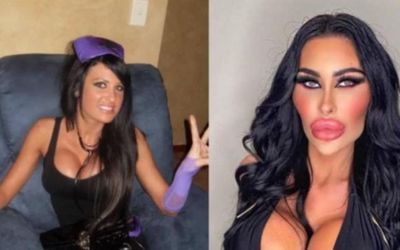 Learn About Tara Jayne's Plastic Surgery: All the Details Here